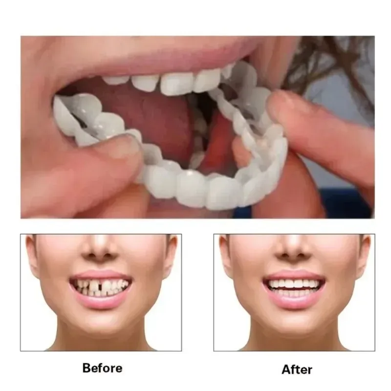 2024 Perfekt fit tandblekning Fake Tooth Cover Snap On Silicone Smile Veneers tänder övre skönhetsverktyg kosmetiska tänder gratis shippingnap på silikon leende faner