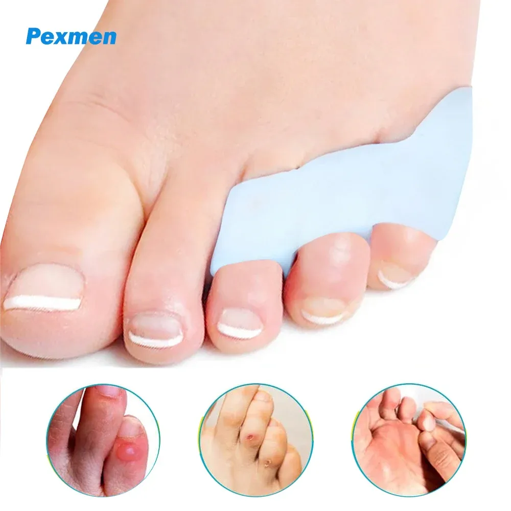 Behandlung Pexmen 2pcs Dreilöcher Little Toe Separator Bunion Korrektor Schmerzlinderung Zehenglätter Beschützer Fußpflegewerkzeug