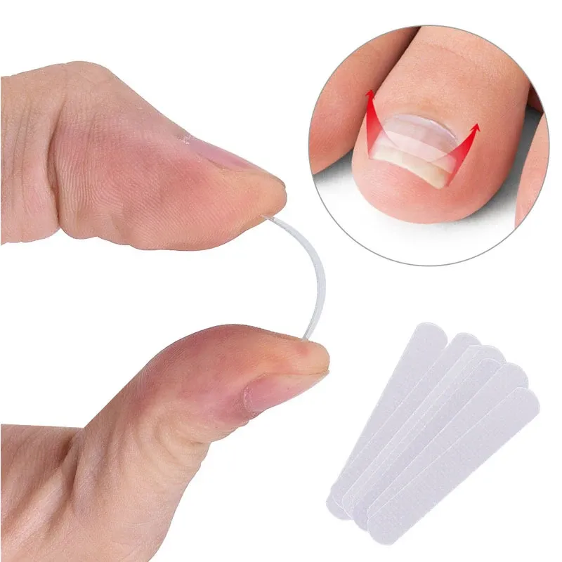 Behandling Ingrown Toe Nail Correction Sticker Patch Paronychia Corrector Pedicure Tools Elastic Patches Foot Care Straintener Treatment