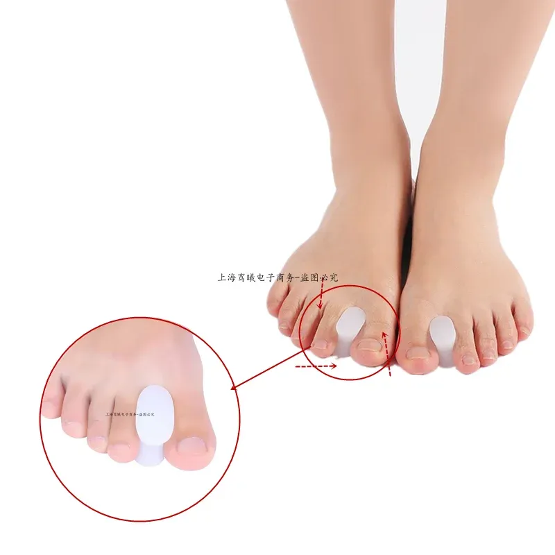 Behandling 2st = 1Pair Gel Toe Separator Foot Care Spacer Silikon Rättare Finger Valgus Hallux Bunion Protector Ortopedisk korrigering