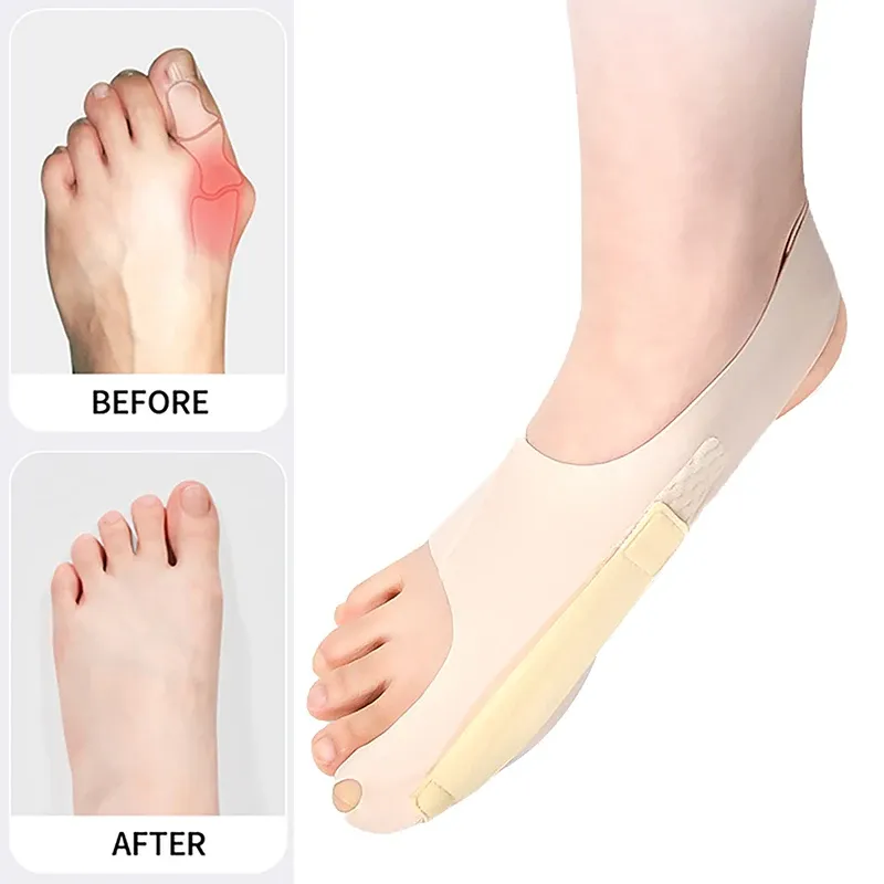 Werkzeug 1 PCs Big Toe Protector Anpassen Sie Unisex Soft Pedicure Socken für Ballen Hallux Valgus Orthopädische Verband Fußpflegezehen Korrektur