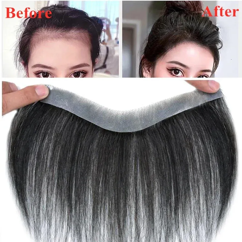 Sistema de substituição de cabelo humano natural peças de cabelo testa para calvície pele fina pu com fitas não-recmos brasileiras 240423