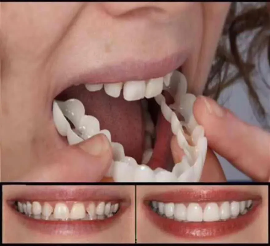 Borsta 2st/ställ in kosmetisk tandprotes övre/nedre tänder täcker tänder blekande hängslen simulering ortodontiska hängslen orala hygienverktyg