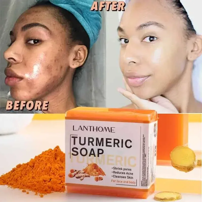 Scrubbers Turmeric Soap Face Cleansing Anti Acne Whitening Skin Lightening Face Remove Pimples Dark Spots Lightening Ginger Handmade Soap