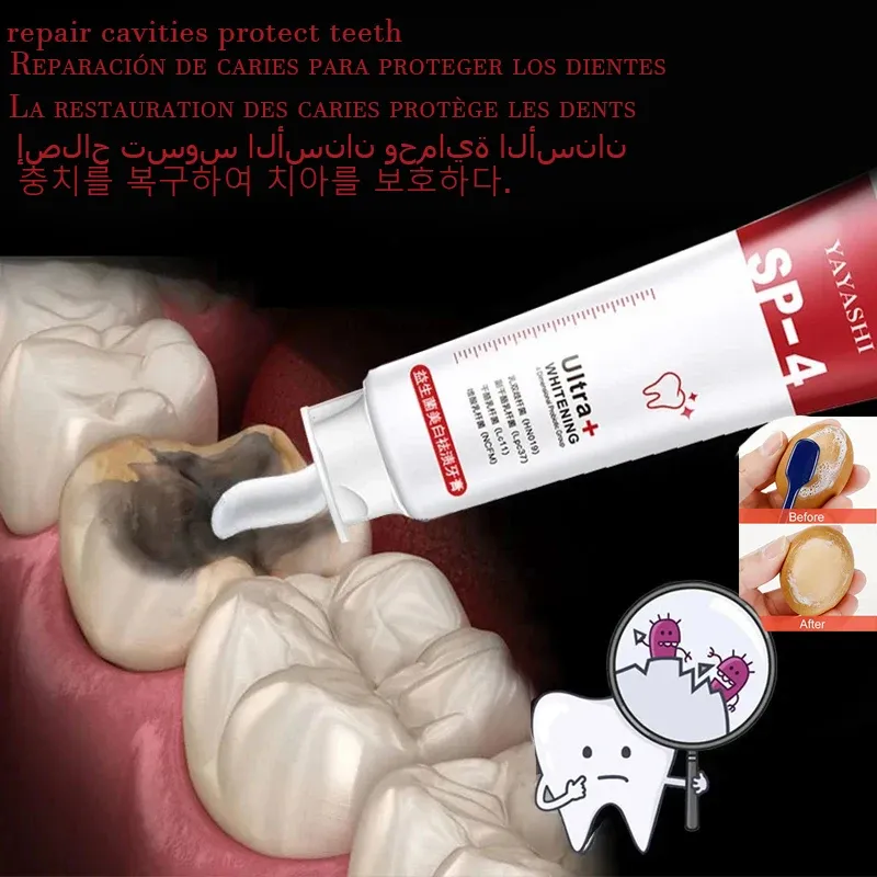Dentifricio dentifricio denti strumenti di pulizia della riparazione delle cavità carries rimozione delle macchie di placca decadimento ingiallito denti denti sbiancamento