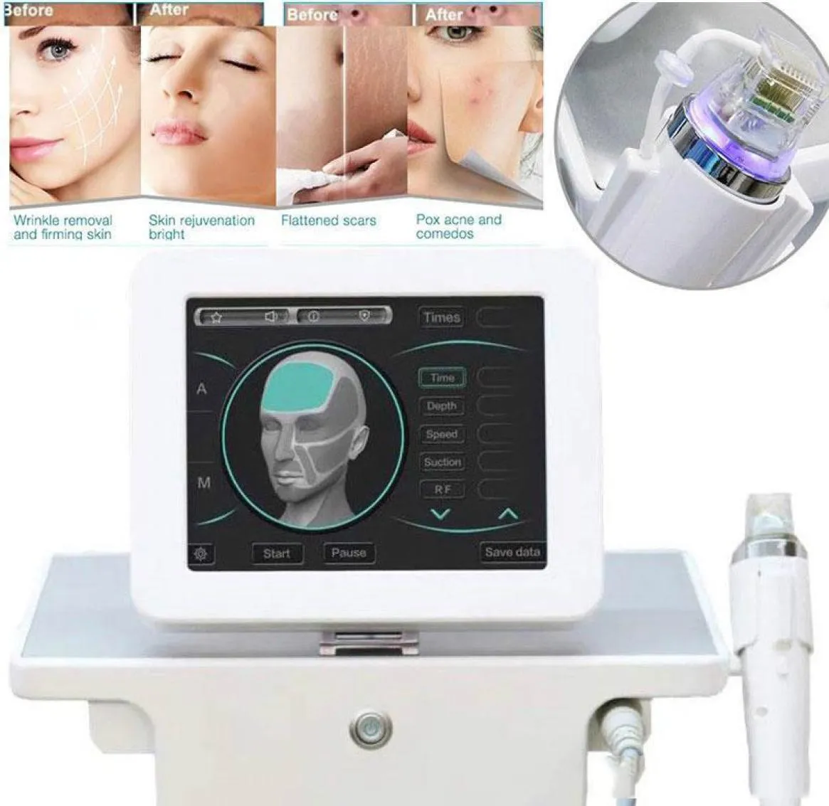 RF Fractional Miconeedle Face Care Gold Micro Needle Skin Rolar Acne Scar Stretch Mark Traitement Professionnel SAL3120895