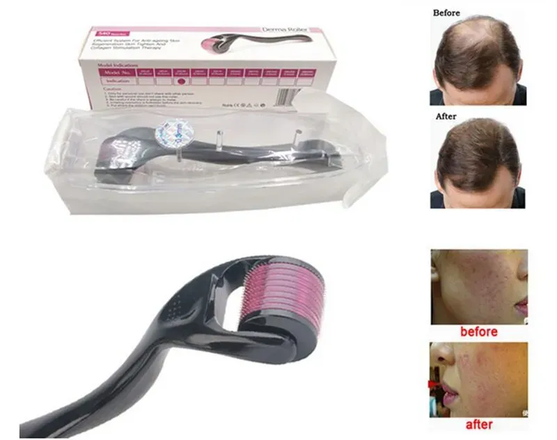 Derma Roller DRS 540 Micro Needle Skin Care Treatment Scalp Hair Beard Re- Growth Anti Wrinkle Acne Scar Agulha Mento Mezoroller