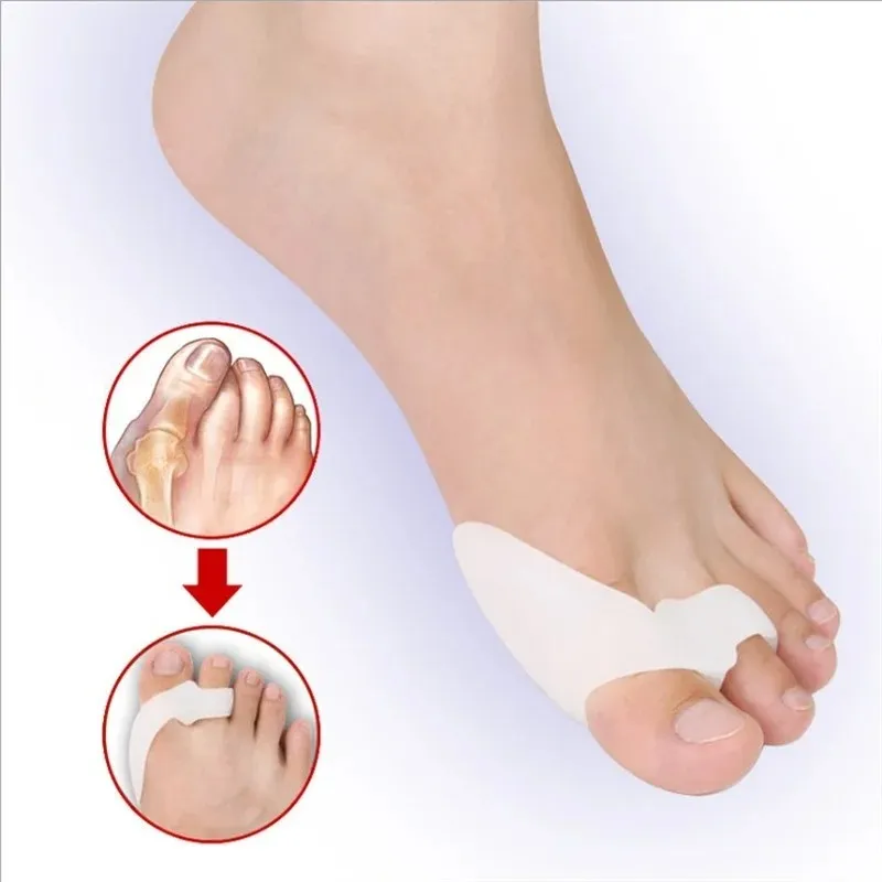 Bone Thumb Corrector Foot Care Tools Bunion Corrector Toe Separators Hallux Valgus Bårkorrigering av tumjusteraren