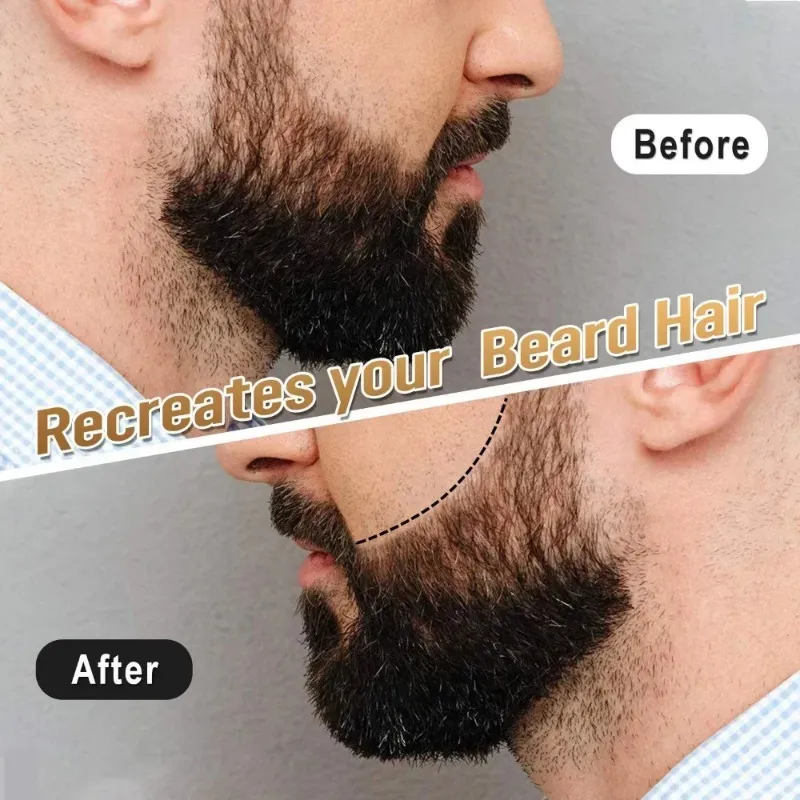 Nowi mężczyźni Broda Wzrost długopisu na twarzy Wąsy naprawa Kształt Odrastanie pióra Broda wzmacniacza Odżywianie Kształtowanie anty wypadania włosów Zestaw Stylowania włosów 1. Broda