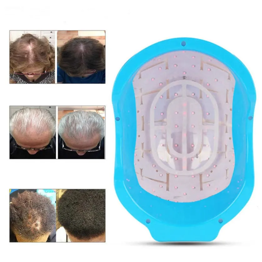 Laser Machine Low Level Laser Therapy 678Nm 80 Diodes Stop Hair Loss Laser Hairs Growth Cap