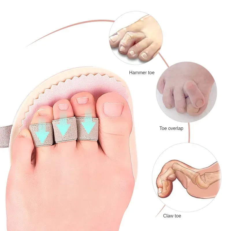 Obróbka 1pcs młotek palca stóp prawidłowy korektor korektorowy hallux valgus korektor bandaż stóp stóp separator podkładki podtrzymywania stóp