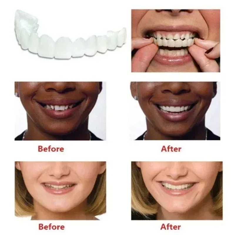 2024 denti perfetti denti sbiancanti fingo cover snap su facce di faleccette di silicone denti utensili di bellezza superiore denti cosmetici di spedizione gratis la copertura sbiancante dei denti