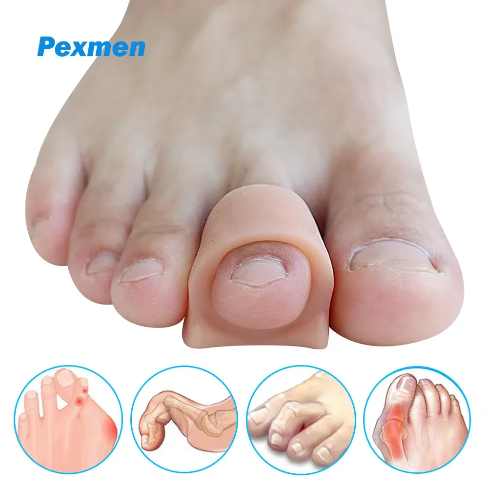 Werkzeug Pexmen 2/4/10pcs Softgel Zehenabscheider Zehen -Abstandshalter Bunion Korrektur für überlappende Hallux Valgus und Hammertoe Foot Care Tool