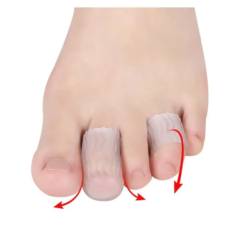 Ademende teenbeschermers Sleeve Bunion Pads Kussen Big Teen Guards Siliconen teen Covers voor bescherming van ingegroeide teennagels