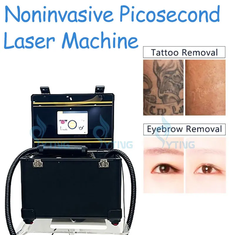 Macina a picosecondi non invasiva Q Switched Nd Yag Laser Pico Laser Rimozione del tatuaggio Trattamento delle lentiggini Ringiovanimento della pelle