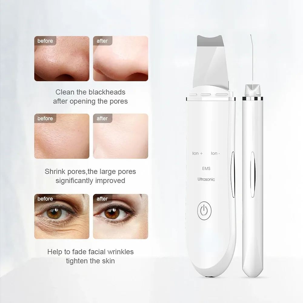 Apparaten ANLAN Ultrasone huidscrubber Diepe gezichtsreinigingsmachine Peeling Schop Facial Pore Cleaner Gezichtshuidscrubber Liftmachine