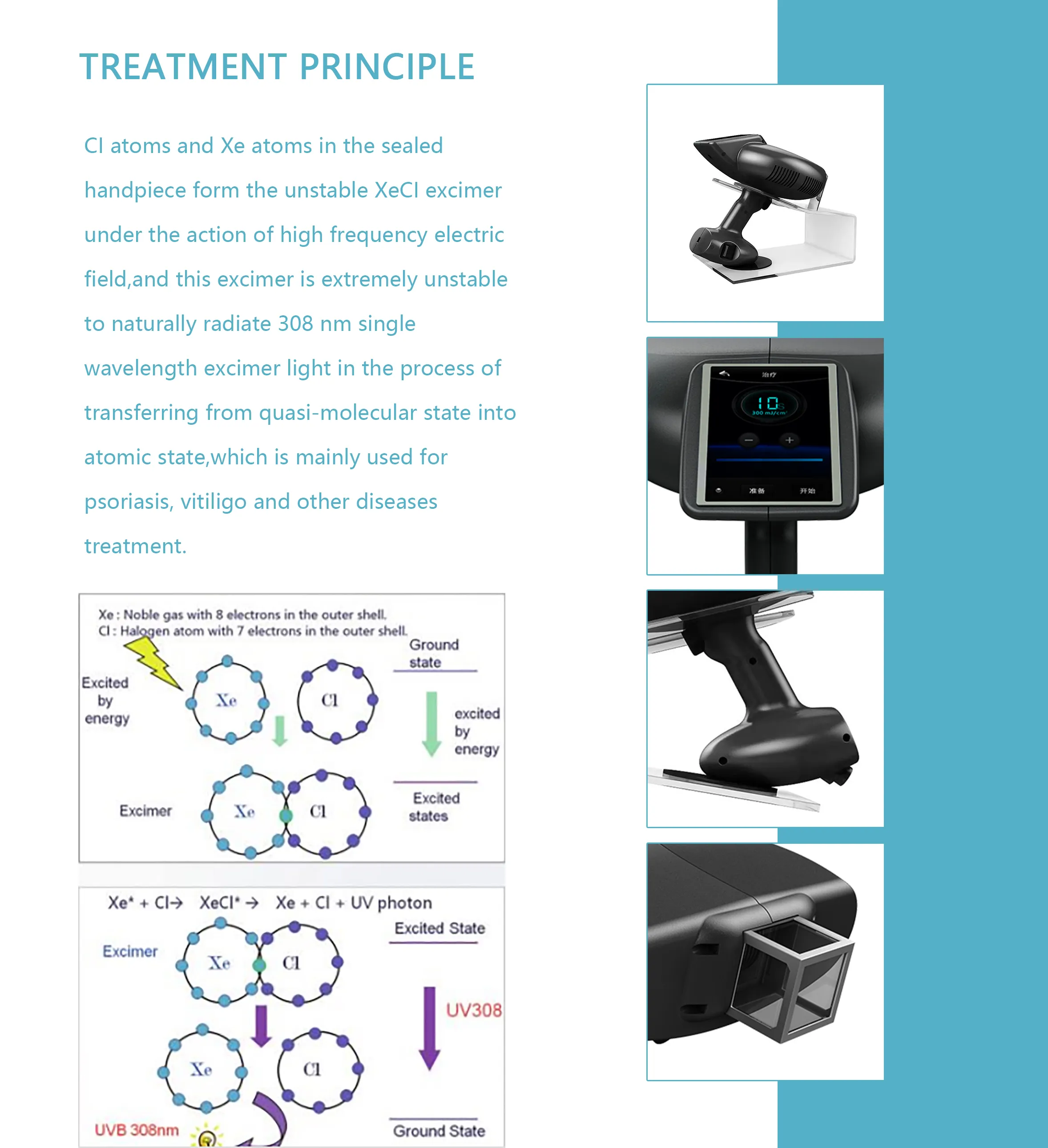 Portable 308nm Excimer Laser Device for Psoriasis Vitiligo Treatment ...