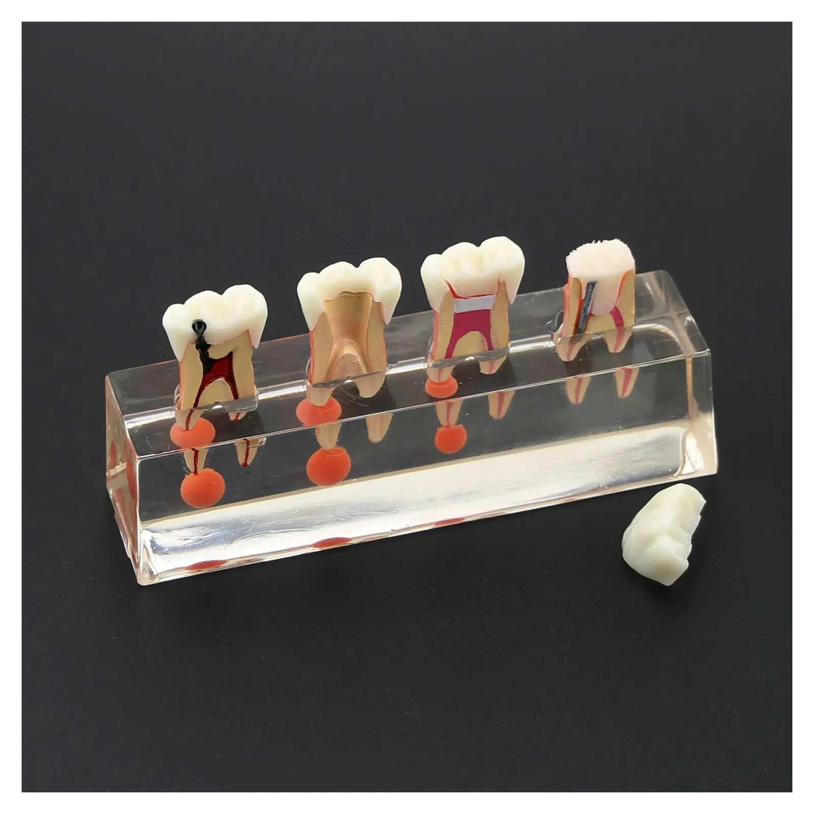Endo Tooth Model Dental Teeth Model M4018 4 Stage Molar Root Canal Endodontic Treatment ...