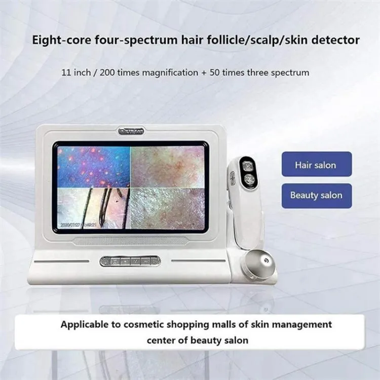 11 Inch Screen Hair Follicle Skin Detector Analyzer Machine Wireless Mobile Software Face Skin Hair Scalp Analysis Machine