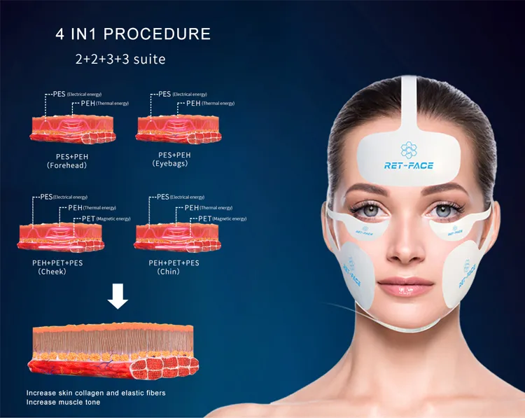 Pe-face Magnetic Pulse RF Heating Facial Massage Machine Emslim Facial Muscle Stimulation Microcurrent Skin Tightening Increase Collagen Vline Face Machine Pe-face rf stimulation skin tighten ems face lift machine - Honkay face lift machine,ems muscle stimulator machine for face,ems face sculpting machine,ems face slimming instrument,ems face lift machine,ems face lift device