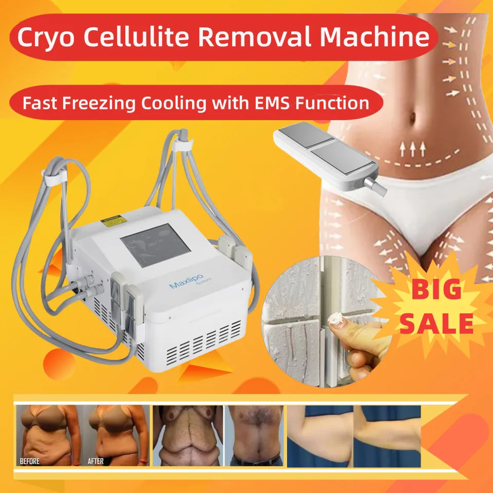 Fat Freezing Machine Cryolipolysis Tiger Bak Borttagning Viktminskning Produkter Kylning Temperatur Viktförlust Celluliter Reduktion EMS Cryo Plates