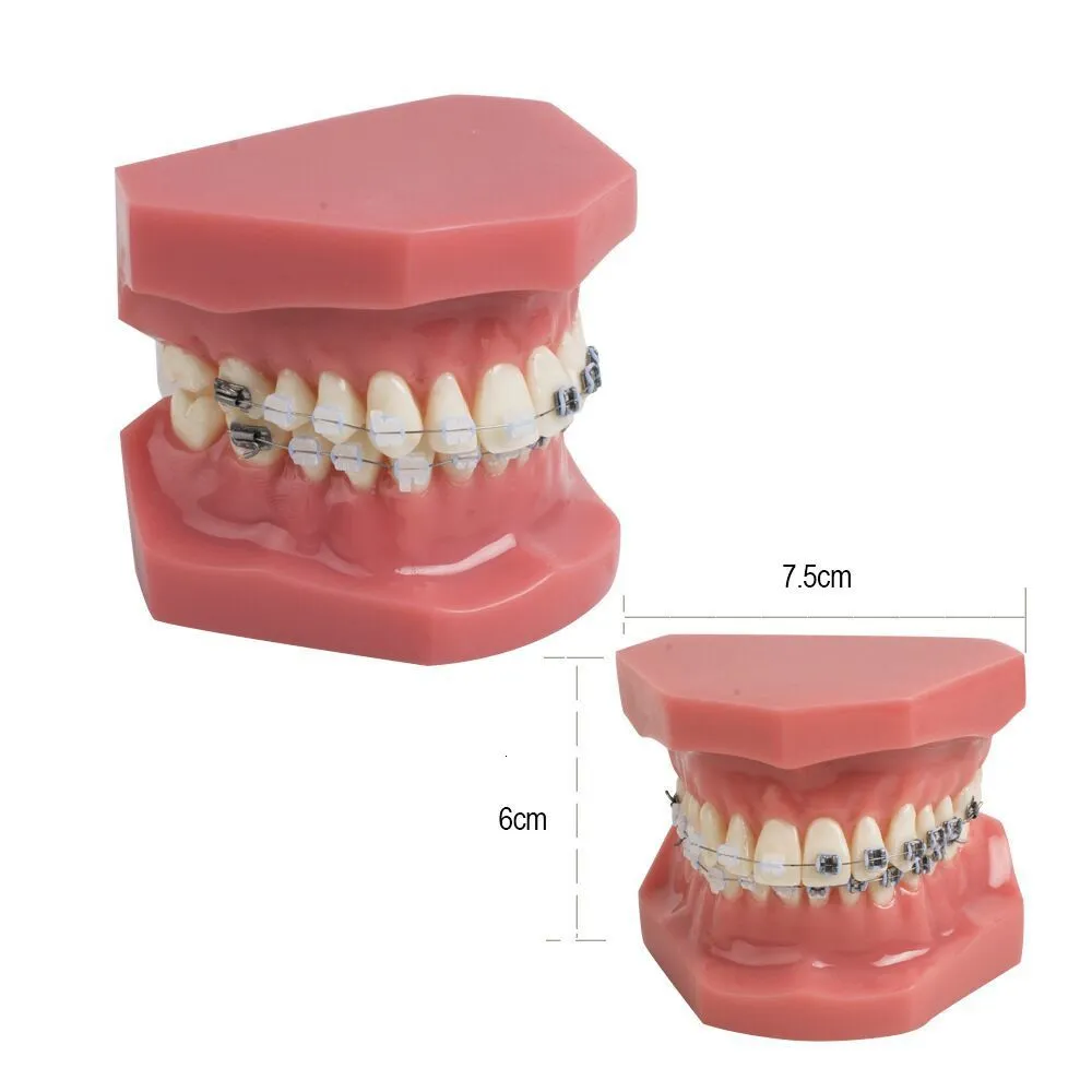 Orthodontics Model with Ceramic and Metal Brackets Teach Model