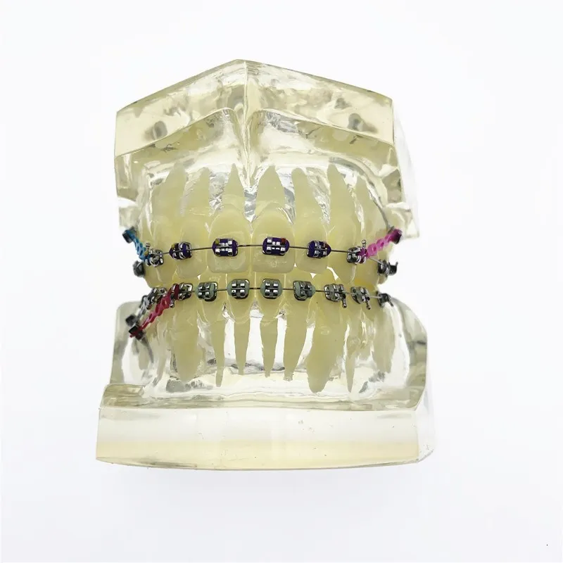 Transparent Orthodontic dental teeth model with...