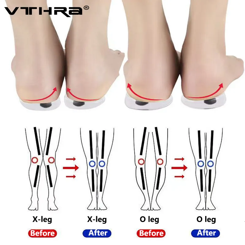 Pièces de chaussures Accessoires 1 paire d'aimants Semelles orthopédiques en silicone Outil de soin des pieds pour hommes Femmes Santé Type de bœuf Jambes Genou Varus Correction Coussinets de talon 230823