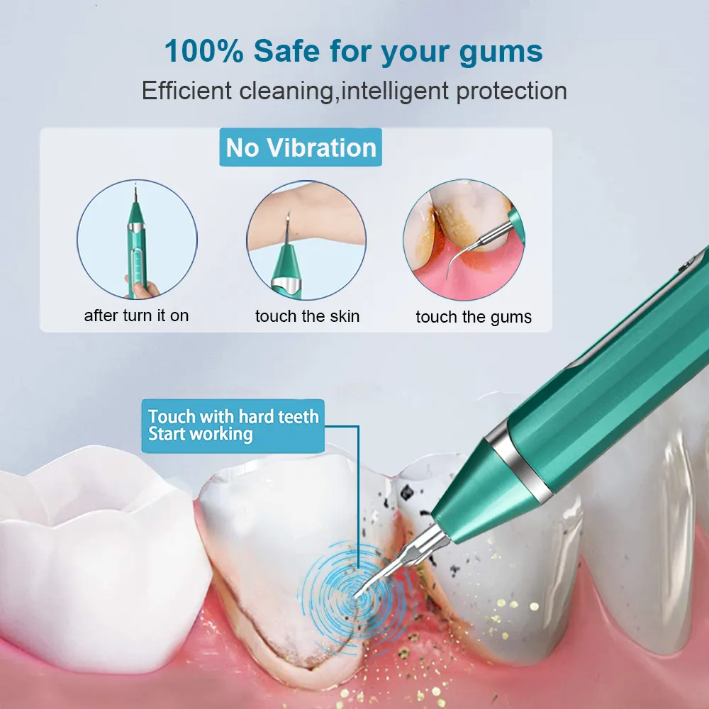 2023 Inne Higiena jamy ustnej Zęby dentystyczne Usuwanie kamienia nazębnego Czyszczenie ultradźwiękowe Płytka nazębna Kamień nazębny Soniczny środek czyszczący do zębów Kamień_voghion.com