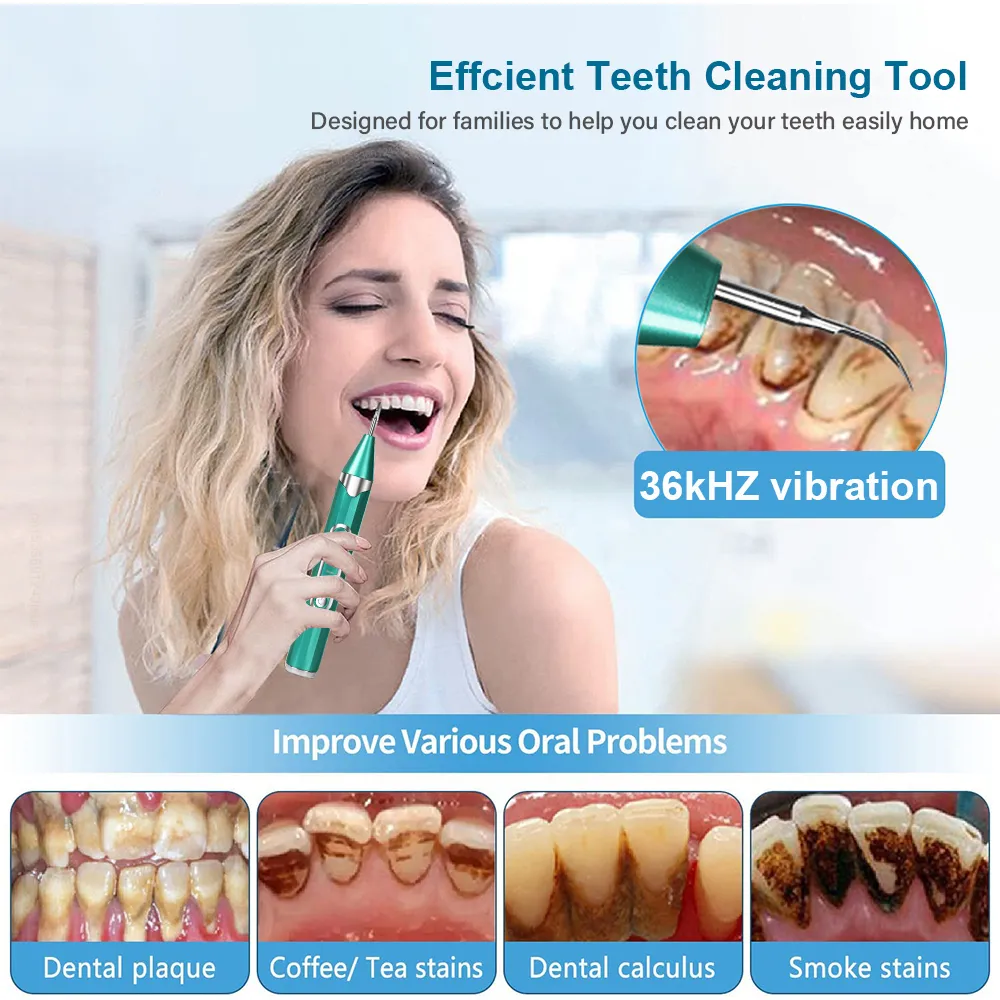 2023 Inne Higiena jamy ustnej Zęby dentystyczne Usuwanie kamienia nazębnego Czyszczenie ultradźwiękowe Płytka nazębna Kamień nazębny Soniczny środek czyszczący do zębów Kamień_voghion.com