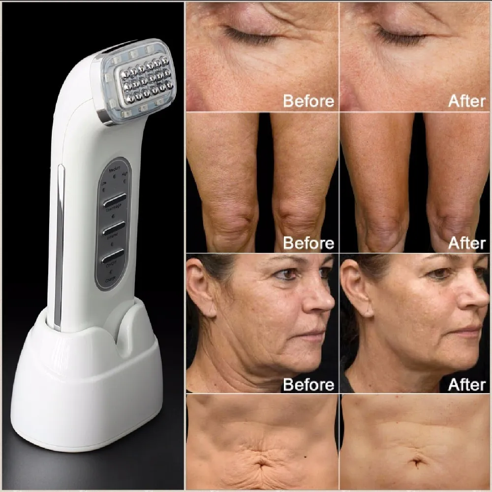 DHgate.com:Real Remove Wrinkles Dot Matrix Radio Frequency Lifting Face ...