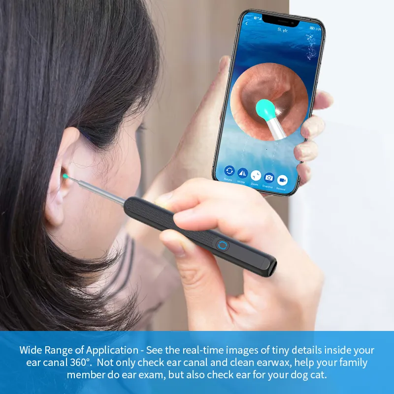 R1 Bebird Smart Visual Bâtonnets de l'oreille Endoscope 300W de haute  précision Mini caméra Earpick Otoscope nettoyant d'oreille de soins de  santé - Chine Endoscope et nettoyant d'oreille prix