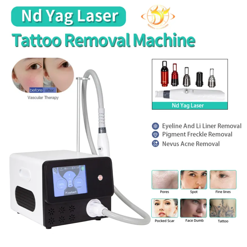 Hochwertiges Q-Switch Nd Yag Laser Tattooentfernungssystem Maschine299