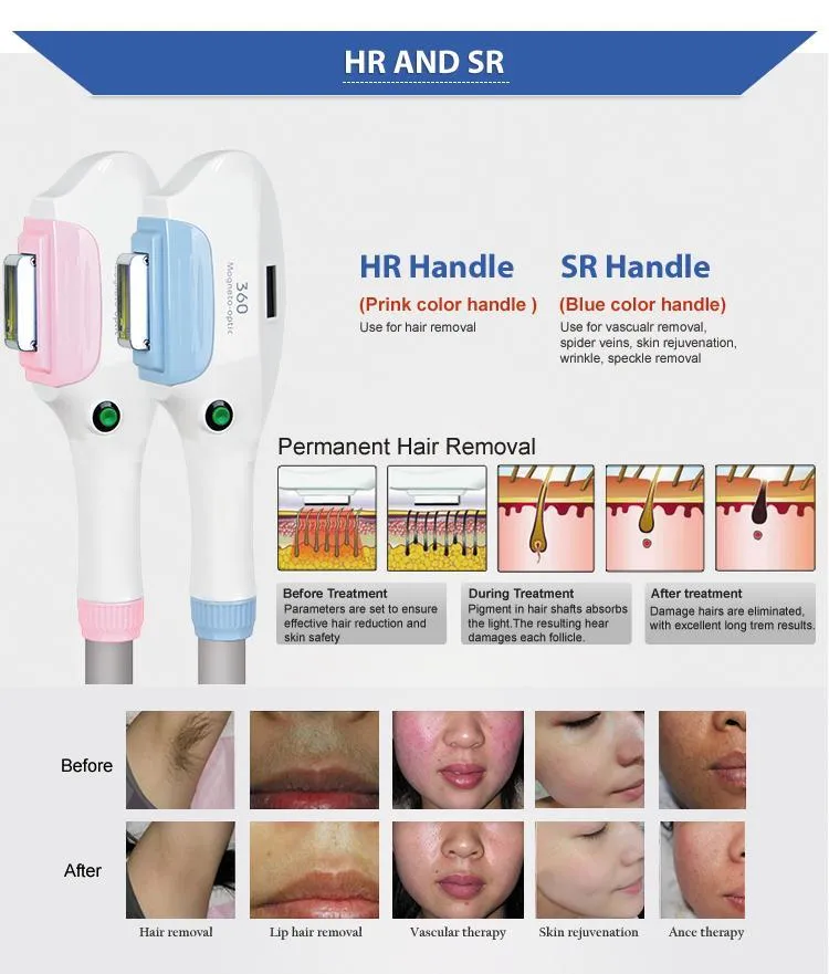 Hottest 4 in 1 rf OPT shr Laser permanent hair removal machines and equipments