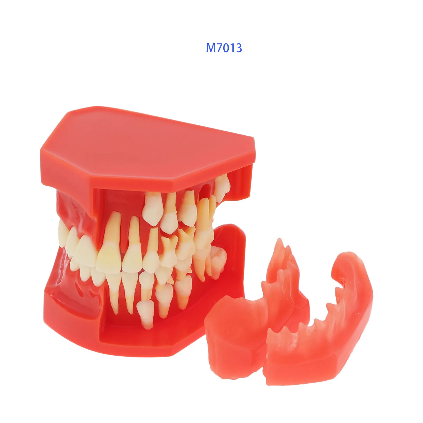 Modèle de Dent D'implant Dentaire, Modèle de Dents Dentaires, Modèle de  Dents Standard Modèle Dentaire Pédagogique à Dents Inférieures Amovibles et