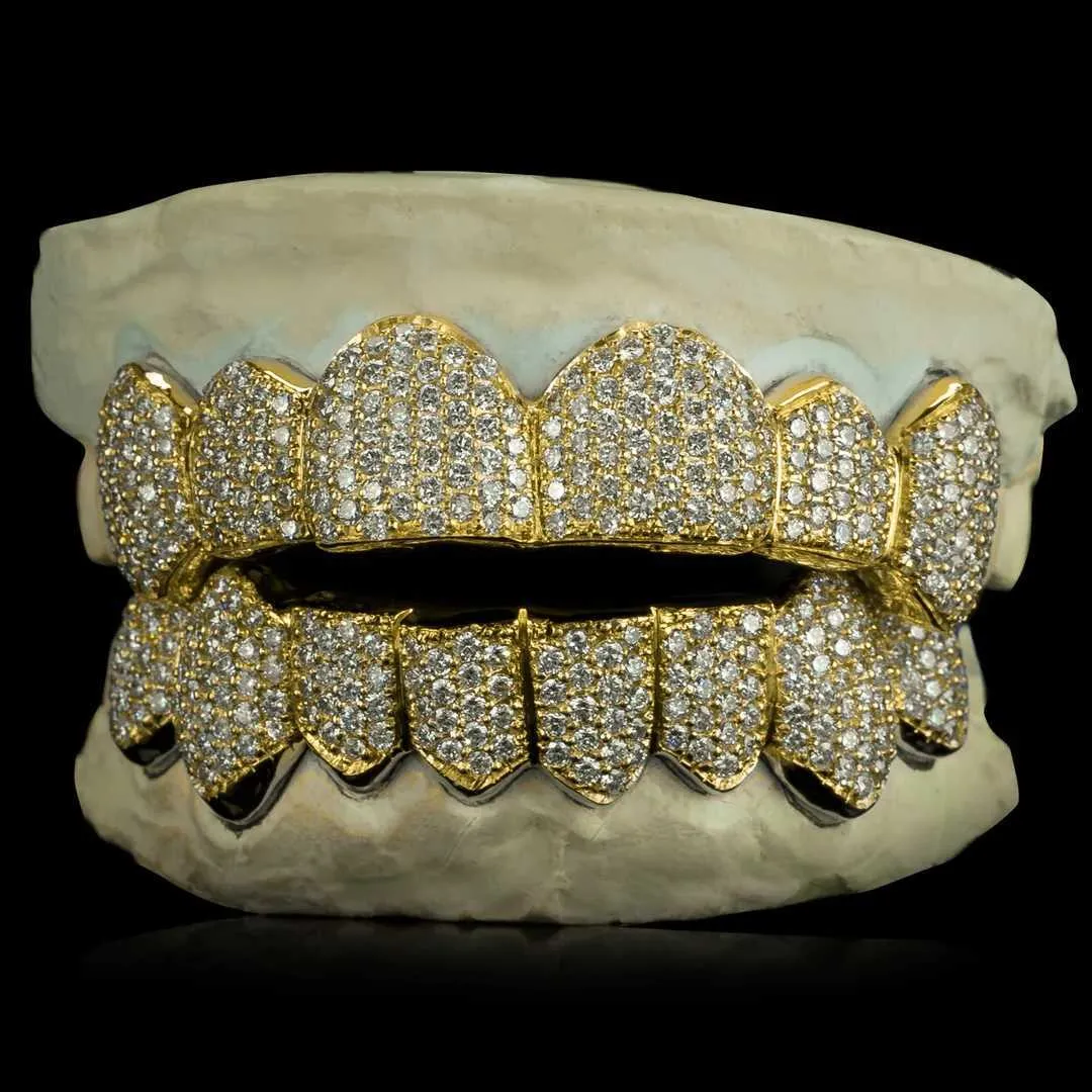 Iced out grillz custom top