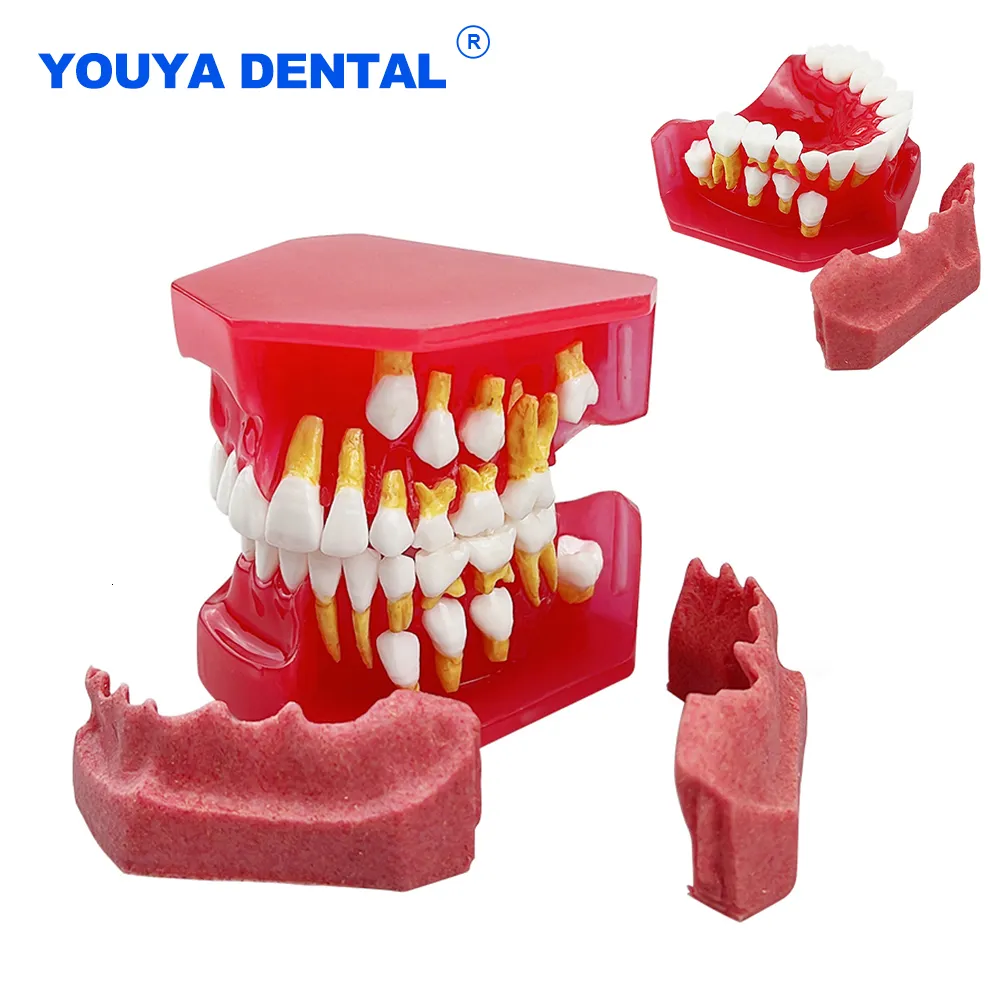 Altro Modello di dente dentale per l'igiene orale Bambini Denti permanenti primari Denti decidui alternati in resina Modello per lo studio Insegnamento Comunicazione 230516
