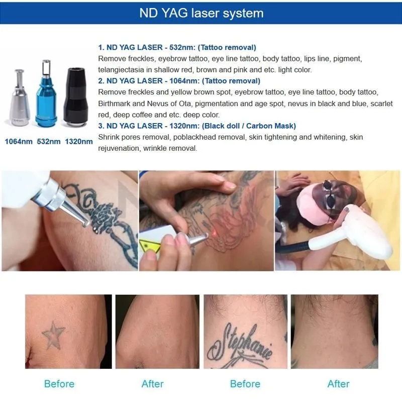 OPT SHR IPL + ND Yag Laser Machine Hair Removal Tattoo Remova RF E-light Skin Rejuventaion Facial Care Beauty Equipment