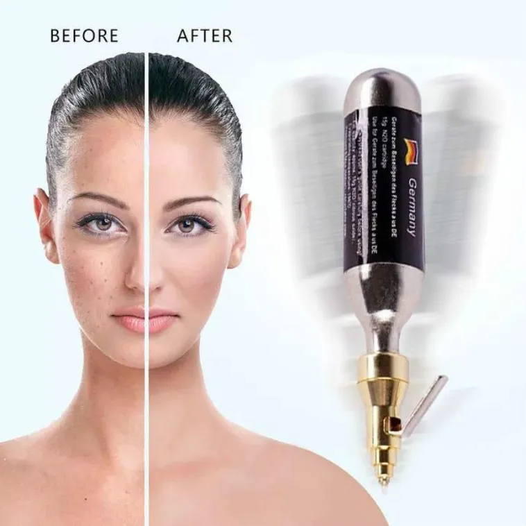 Máquina adelgazante Cryopen Liquid Nitrogen Spray Freeze N2O Cartucho Crioterapia Skin Spot Mole Cryo Pen 16 Gram Cooling