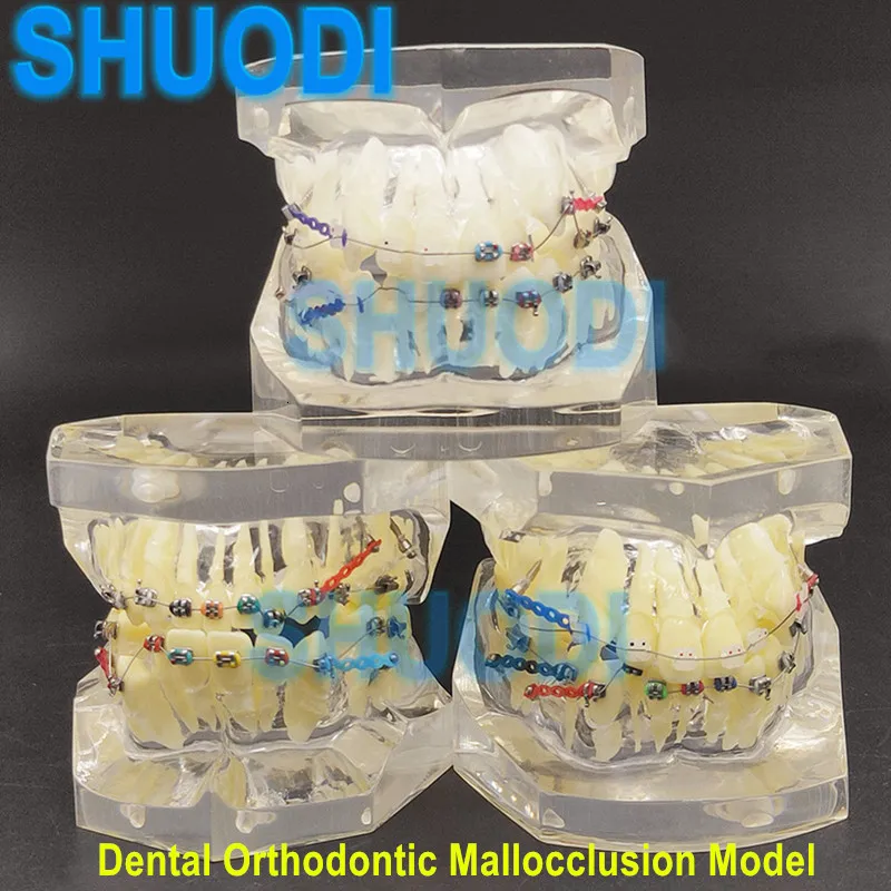 Other Oral Hygiene 1 piece Transparent Dental Orthodontic Mallocclusion Model with Brackets Archwire buccal tube for Patient Communication 230524