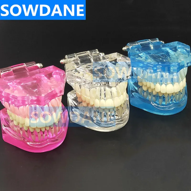 Other Oral Hygiene 1pc Dental Standard Tooth Model Orthodontic Model for Patient Communication Dental Study Clinic Model Tool Unremovable Teeth 230524
