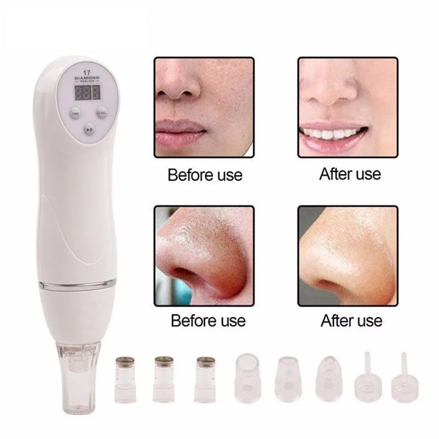 TM-MD004 110-220V Diamond Blackhead Vacuum Suction remove Scars Acne Marks face Beauty device Dermabrasion Microdermabrasion home 310p