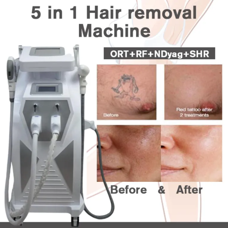 Laser Machine 3In1 Opt Hair Removal Maquina Pico Picosecond Laser Tattoo Pigment Rf Radio Frequency Equipment557