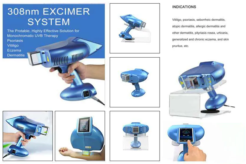 High-Intensity 308nm Narrowband UV Phototherapy Machine for Vitiligo ...