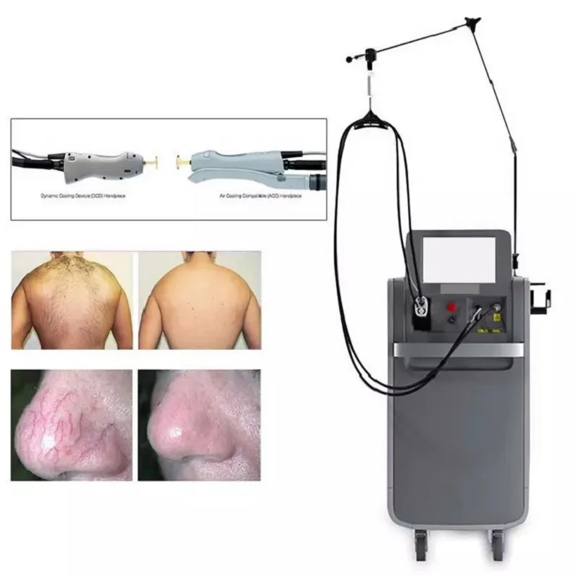 Heet verkoop ontharing Alex 755 nm laser pigmentverwijdering en yag laser 1064nm laser ontharing machine schoonheidssalonapparatuur