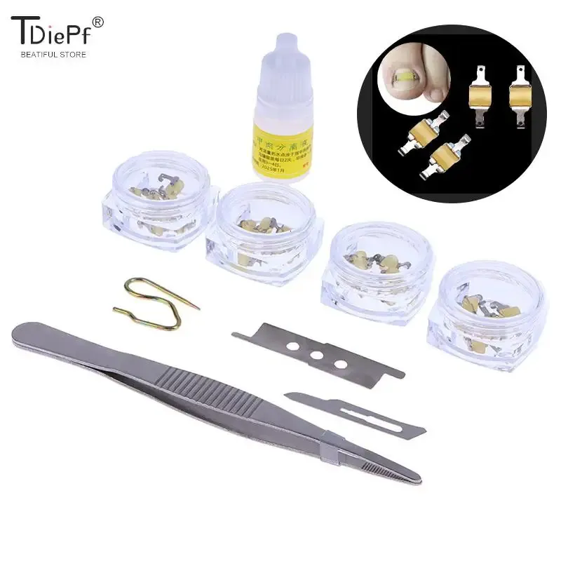 Herstel insluiting teen nagelbehandeling ingegroeide teennagelcorrectorgereedschap pedicure professionele correctie voetzorg 231222