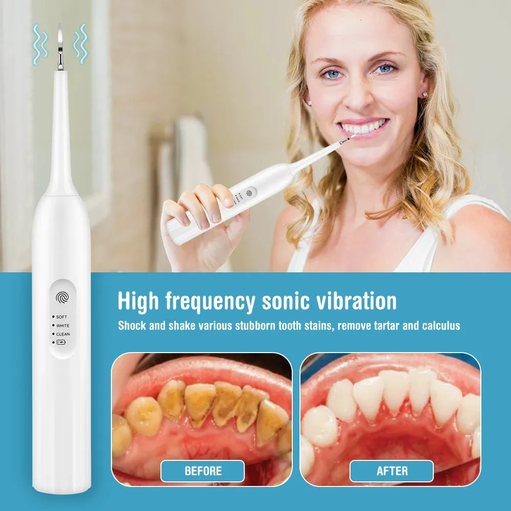 Electric Dental Sonic Vibration Teeth Cleaner Stains Tartar Remove ...