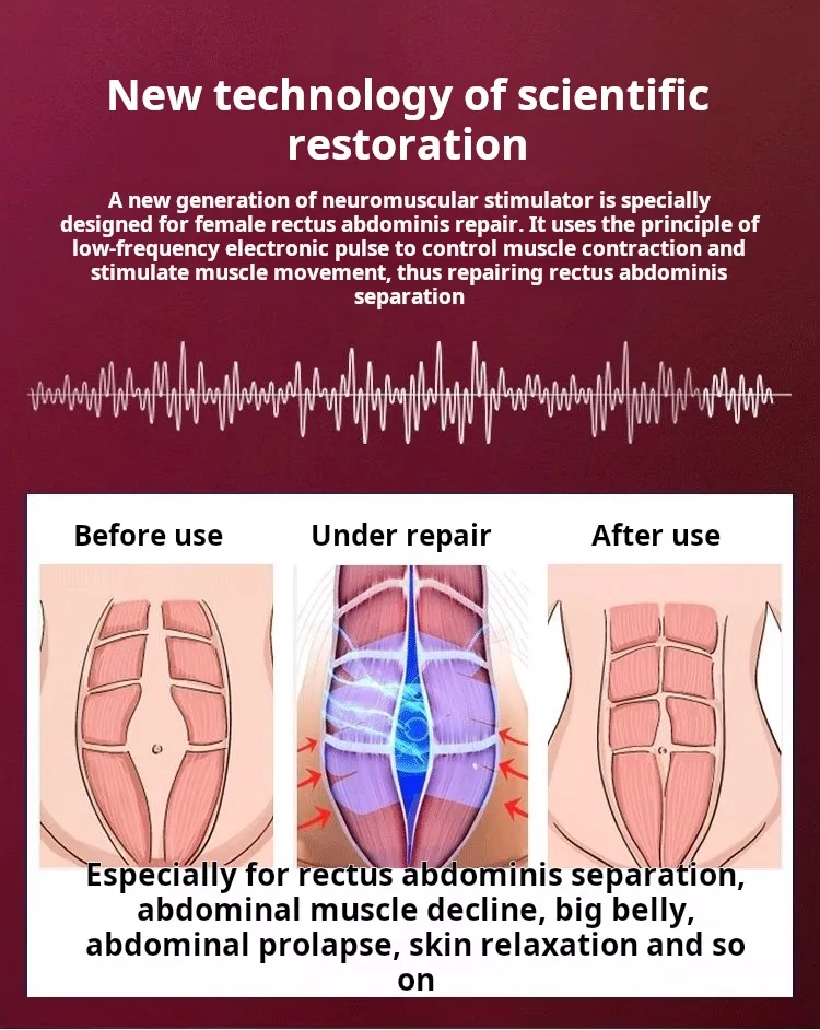 Gameplay bekkenbodemspierherstelapparaat verticale spraakscorerapport Postpartum bekkenreparatieapparaat Kegel training herstelapparaat Hifu Alma