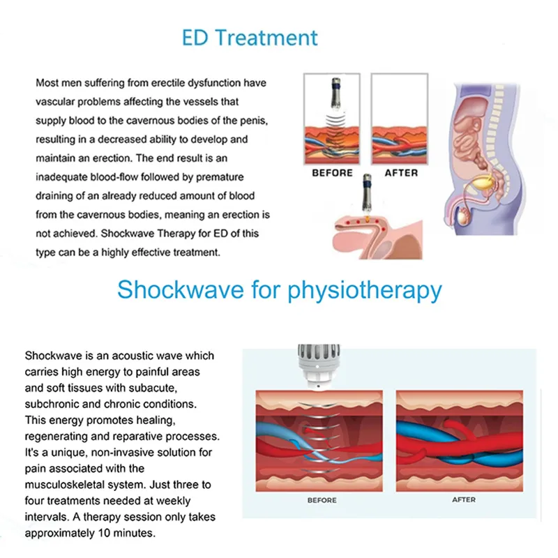 Physical Therapy Machine Relieve Muscle Pain Physical Beauty Equipment Shock Wave Physiotherapy Device ED Treatment And Bone Healing Clinic Use Shock wave physical therapy machine pain relief ed treatment - Honkay shockwave therapy machine,shock wave therapy machine pain relief,shock wave therapy device,shock wave machine,shock wave