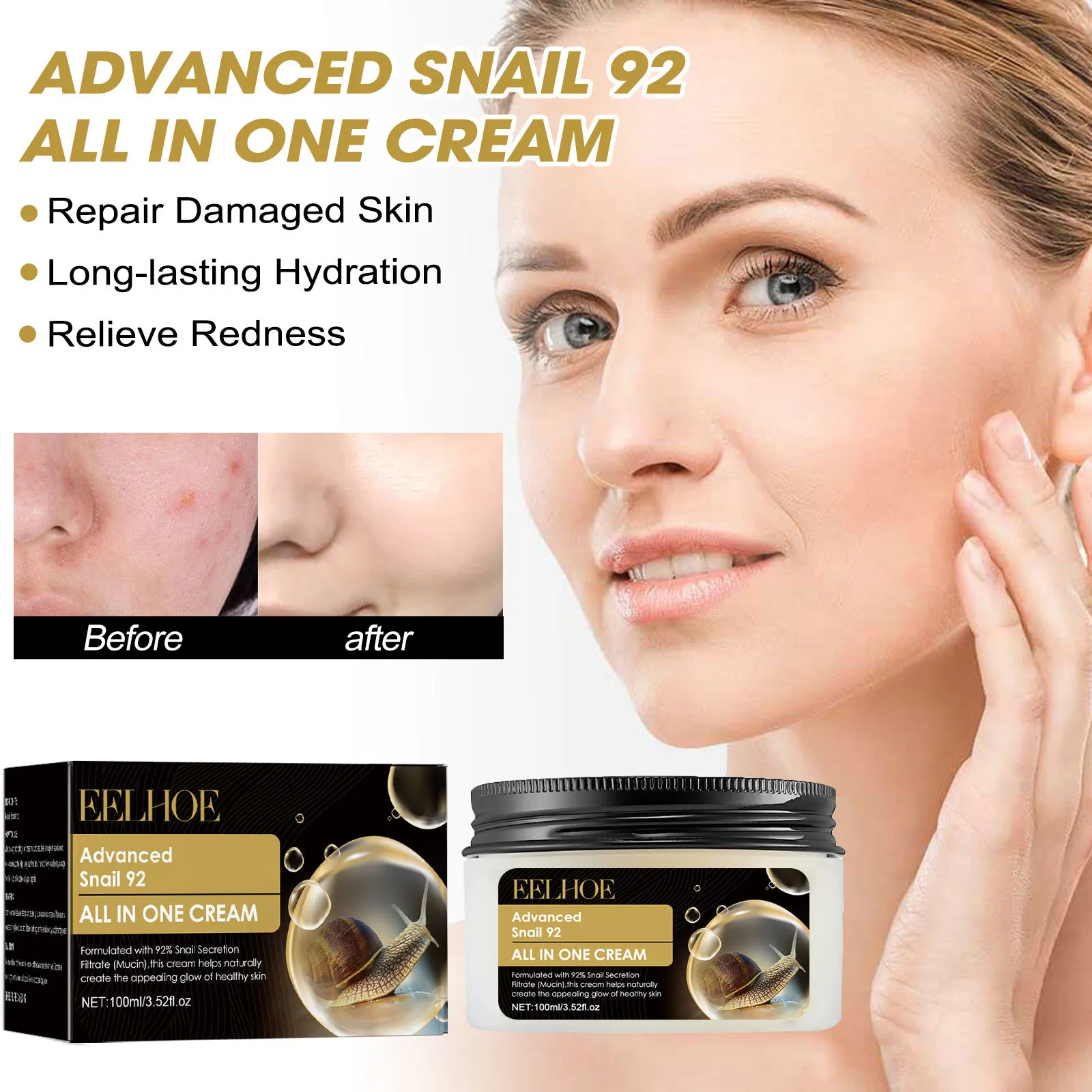 Advanced Snail 92 All In One Cream Moisturizer Enriched With 92 Of